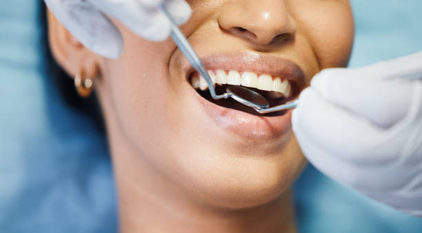 Best Emergency Tooth Extraction in Statham, GA