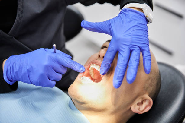 Best Emergency Treatment for Dental Infections or Abscesses in Statham, GA