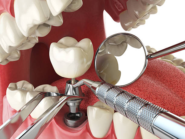 Fast & Reliable Emergency Dental Services in GA